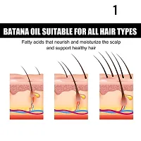 Hair Fast Growth Oil Effective Baldness Repair Hereditary Hair Loss Postpartum Hair Loss Seborrheic Hair Loss Repair Of Hairline-thumb1