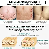 Stretch Mark Cream To Remove Postpartum Obesity Pregnant Women Repair Anti-Aging Anti-Winkles Firming Body Cream-thumb1