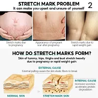 Pregnancy Mark Repair Cream Deep Stretch Mark Removal Firming Cream Repai-thumb2