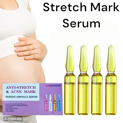 Maternity Stretch Mark Removal Cream Buttock Breast Mark Skin Care