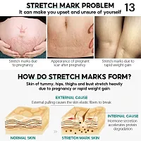 Stretch Mark Burn Fade Acne Spots Section Scars Gel Whitening Repair Smooth Whitening Skin Care-thumb1