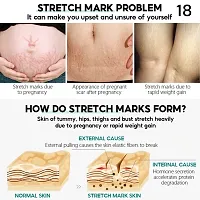 Stretch Mark Cream Remover Anti Stretch Mark Moisturizer For Pregnancy-thumb3