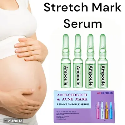 Stretch Marks Burn Keloid Spot Treat Gel Herbal Smooth Whiten Face Skin Care