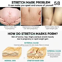 Scar Removal Cream Fast Removal Skin Scars Treat Surgery Scars Stretch Marks-thumb2