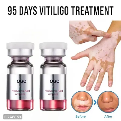 White Spot Ointment Moisturing Disease Treatments Tag Remove Serum Cream 95 Days 20ml(2 pcs)
