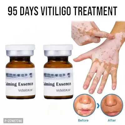 Repair Leukoplakia Reduce Pigment Melanin Antibacterial Skin Care Vitiligo Cream  20ml (2pcs)