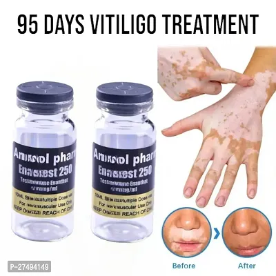 Skin Marks Skin Vitiligo Care For Adults Cream, White Spot Removal 95 days 20ml (2pcs)