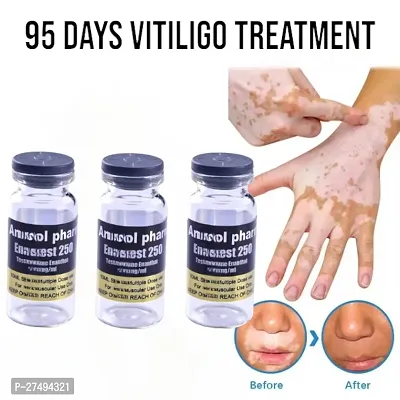 White Spot Ointment Moisturing Disease Treatments Tag Remove Serum Cream vitiligo cream 95 days 30ml (3pcs)