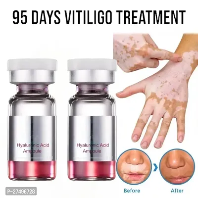 Ayurvedic remedy for pigmentation in Vitiligo/ Herbal Extract Vitiligo Ointment Remove Cream 95 days 20ml (2pcs)-thumb0