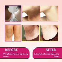 INLAZER'S Intimate Area Lightening  Whitening Cream For Underarm, Bikini Area, Neck, Thigh, Intimate Area, Elbow Intense Dark Spot Removal For Men Women (Removing Dark Patches)-thumb2