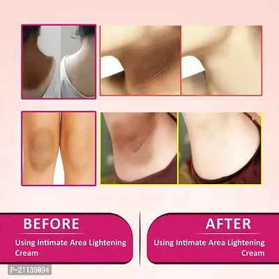 INLAZER'S Intimate Area Lightening  Whitening Cream For Underarm, Bikini Area, Neck, Thigh, Intimate Area, Elbow Intense Dark Spot Removal For Men Women (Removing Dark Patches)-thumb3