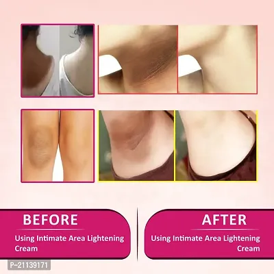 INLAZER Intimate Area Lightening  Whitening Cream For Underarm, Bikini Area, Neck, Thigh, Intimate Area, Elbow Intense Dark Spot Removal For Men Women (Removing Dark Patches)-thumb3