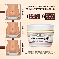 INLAZER Anti Stretch Marks Cream | Uneven Skin Tone| Stretch Marks  Ageing Signs for Glowing Skin  Moisturizing Cream, Stretch mark remover for Stomach, thighs  all body parts, For Men Women-thumb1