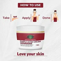 Inlazer Anti Acne, Pimple  Scar Removal Cream | Glowing Skin, Face Moisturizer Flaking  Inflammation | Pimple Cream For Face-thumb3