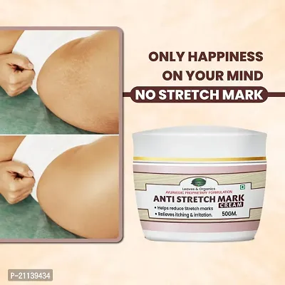 INLAZER Anti Stretch Marks Cream | Removes Prevent  Heal Stretch Marks, Scar removal and Stretch mark remover for Stomach, thighs  all body parts, For Men Women-thumb3