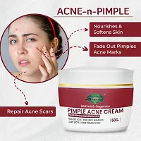 Inlazer Anti Acne, Pimple  Scar Removal Cream | Glowing Skin, Face Moisturizer Flaking  Inflammation | Pimple Cream For Face-thumb4