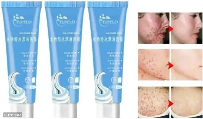 combo of 3 salicylic ice cream mask