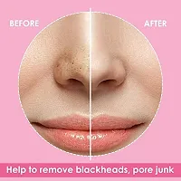 Nose Strips Blackhead Remover Skin Care Cleansing Charcoal Nose Strips Blackheads, Whiteheads Remover, Pore Cleanser, with Natural Extracts, for Women, All Skin Types (6 Strips)-thumb1