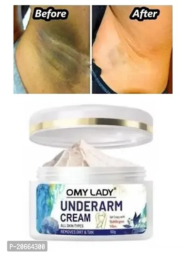 Omy Lady Underarm Cream, Remove Dirt  Tan