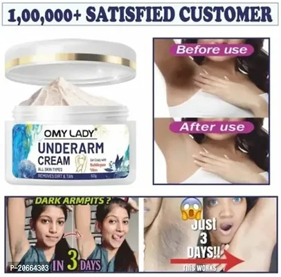 Omy Lady Underarm Cream, Remove Dirt  Tan
