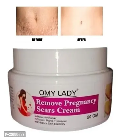 Omy Lady Remove Pregnancy Scars Cream