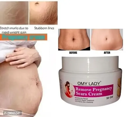 Omy Lady Remove Pregnancy Scars Cream