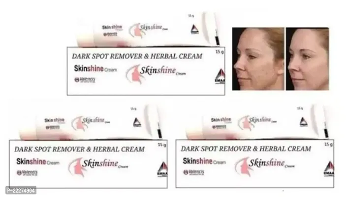 Skinshine Fairness Cream Night Cream Pack of 3