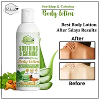 Rabenda Soothing Calming And Healing Body Lotion With Turmeric And Aloevera Cream For Normal,Dry And Itchy Skin- 100 Ml-thumb2
