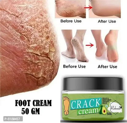 Rabenda Foot Care Cream For Rough, Dry And Cracked Heel | Feet Cream For Heel Repair |Healing And Softening Cream- 50 Grams-thumb0