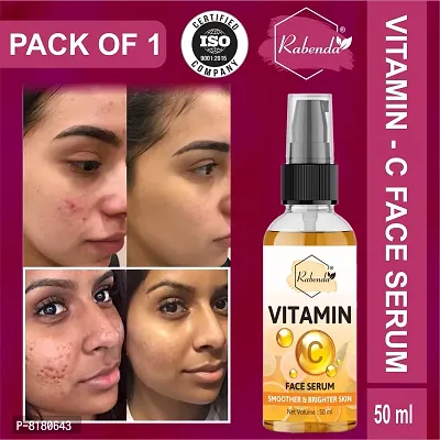 Rabenda 1% Vitamin C Face Serum With Mandarin For Glowing Skin With Pure Ethyl Ascorbic Acid For Hyperpigmentation And Dull Skin, Fragrance-Free,50 ml