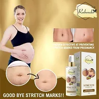 Rabenda Present Repair Stretch Marks Removal - Natural Heal Pregnancy Breast, Hip, Legs- 100 ml-thumb1