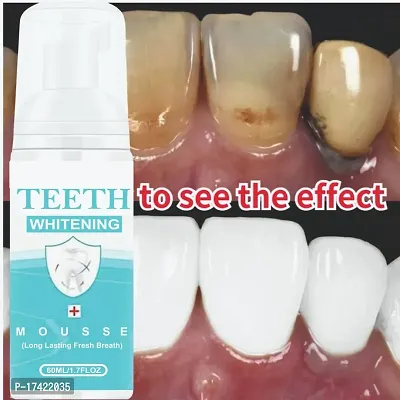 Teeth Whitening Foam Toothpaste Makes You Reveal Perfect  White Teeth, Natural Whitening Foam Toothpaste Mousse with Fluoride Deeply Clean Gums Remove Stains-60ml