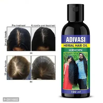 Adivasi Hair Oil regrows thinning eages Pack Of -1-thumb0