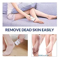 Buyerskart Pedi Vac Feet Care callus Remover Electronic Foot Files Pedicure Pedi Vac for Hard |Cracked Skin Callus remover for women-thumb2