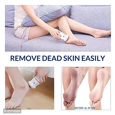 Buyerskart Pedi Vac Feet Care callus Remover Electronic Foot Files Pedicure Pedi Vac for Hard |Cracked Skin Callus remover for women-thumb3