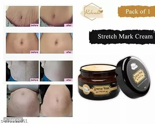 Rabenda Stretch Marks Cream To Reduce Stretch Marks  Scars 50 Gm Cream Pack Of 1-thumb0