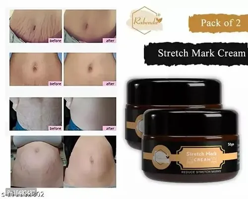 Rabenda Stretch Marks Cream To Reduce Stretch Marks  Scars 50 Gm Cream Pack Of 2-thumb0