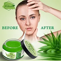 Rabenda Natural Aloe Vera Gel 92%Moisturizer Gel Cream Acne Blackheads Treatment For Skin Repair Shrink Pores Sleep Mask SkinCarenbsp;nbsp;(100 g) pack of 1-thumb4