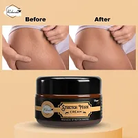 Rabenda Stretch Marks Cream To Reduce Stretch Marks  Scars 50 Gm Cream Pack Of 1-thumb1