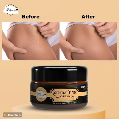 Rabenda Stretch Marks Cream To Reduce Stretch Marks  Scars 50 Gm Cream Pack Of 1-thumb2