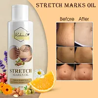 Rabenda Present Repair Stretch Marks Removal Natural Heal Pregnancy Breast Hip Legs Mark Oil 100 Ml Pack Of 1-thumb2