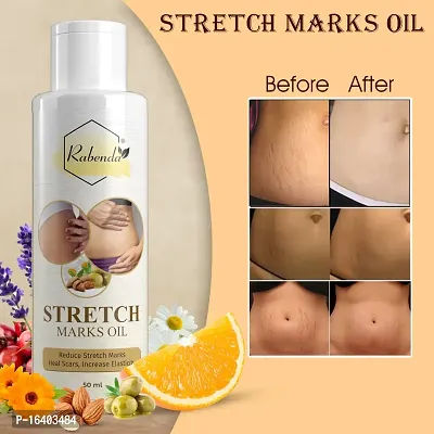 Rabenda Present Repair Stretch Marks Removal Natural Heal Pregnancy Breast Hip Legs Mark Oil 100 Ml Pack Of 1-thumb3