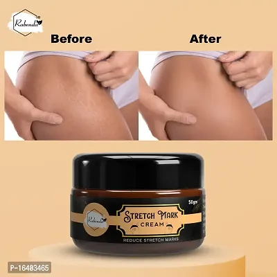 Rabenda Stretch Marks Cream To Reduce Stretch Marks  Scars 50 Gm Cream Pack Of 1-thumb5