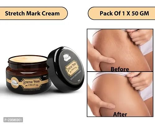 Stretch Marks Cream to Help Minimize Stretch Marks 50gm