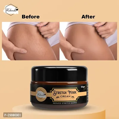 Stretch Marks Cream to Help Minimize Stretch Marks 50gm-thumb2