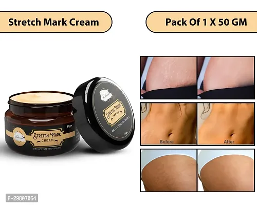 Stretch Marks Cream 50 gm