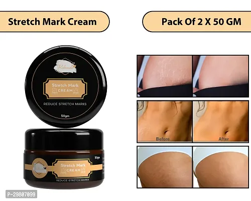 Stretch Marks Cream 50 gm Each Pack of 2