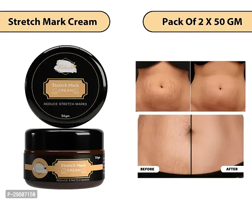 Stretch Marks Cream to Help Minimize Stretch Marks 50 g Pack of 2