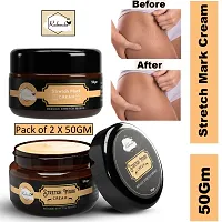 Stretch Marks Cream to Help Minimize Stretch Marks 50 g Pack of 2-thumb2