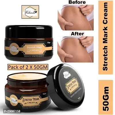 Stretch Marks Cream to Help Minimize Stretch Marks 50 g Pack of 2-thumb3